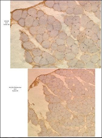 MAP1LC3A / LC3A Antibody