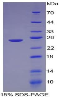 Rat LAMA1 / Laminin Alpha 1 Protein (Recombinant His-T7)