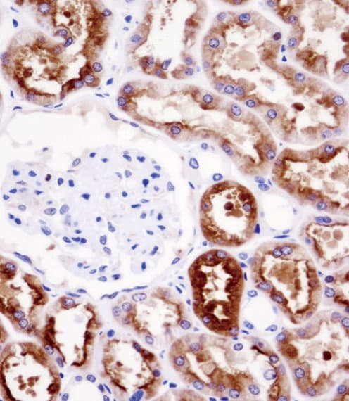 Polyclonal Rabbit anti-Human PDZK1 Antibody (aa196-224, IHC, WB)