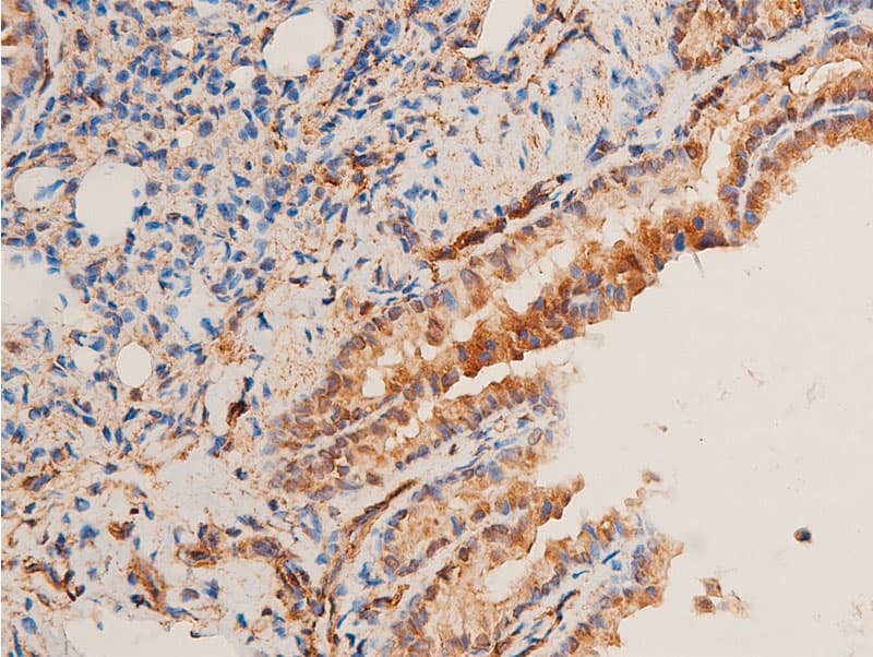 Polyclonal Rabbit anti-Human CHEK1 / CHK1 Antibody (phospho-Ser296, IHC, IF, WB)