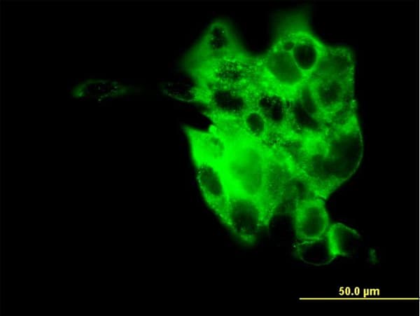 SYT4 Antibody (clone 5F8)