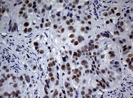 NBN / Nibrin Antibody (clone OTI2E10)