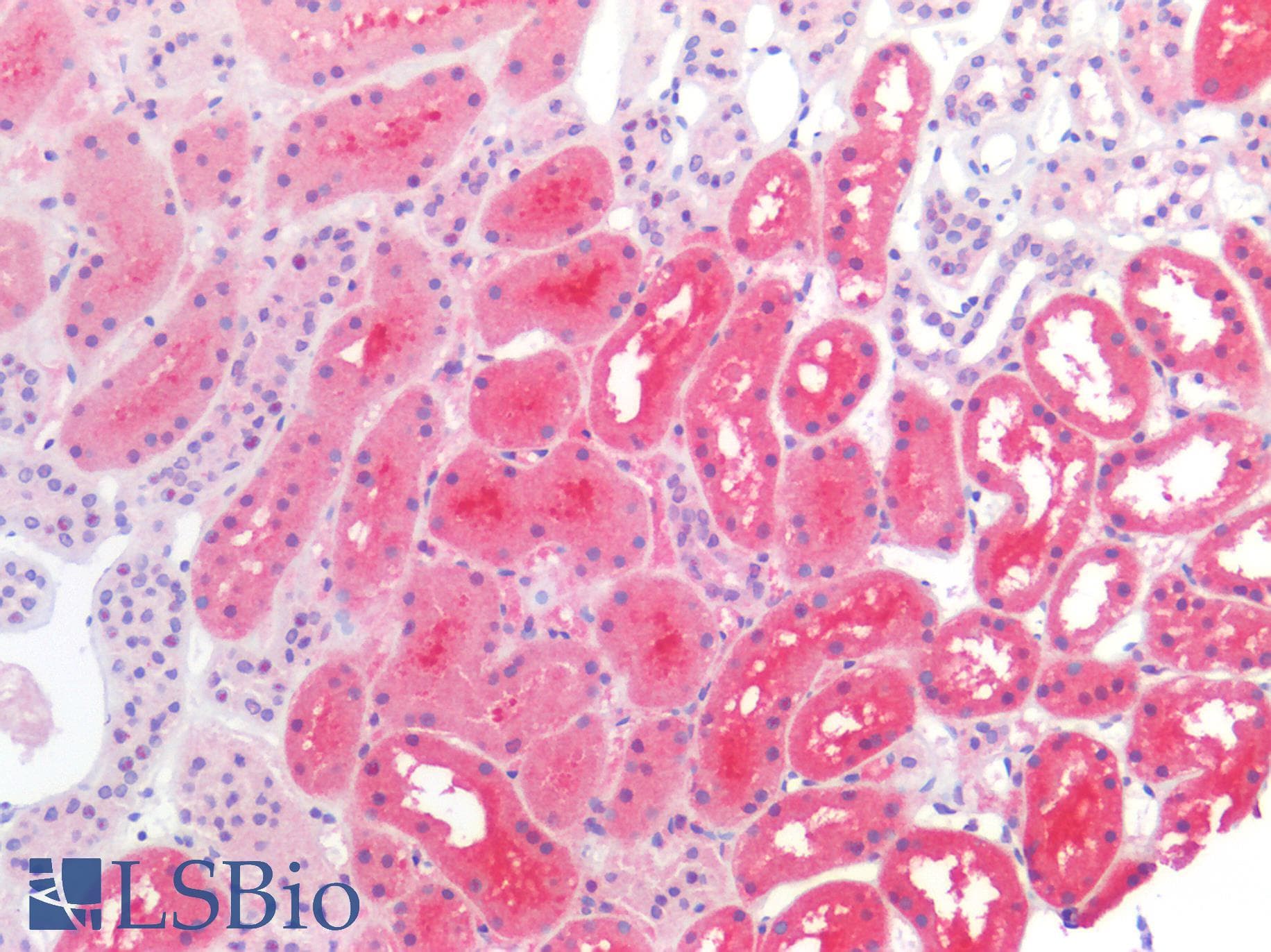 IHC-plus™ SHMT / SHMT1 Antibody (clone AT26E5)