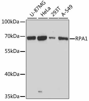 RPA70 / RPA1 Antibody
