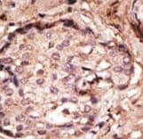 GFAP Antibody (aa10-40)
