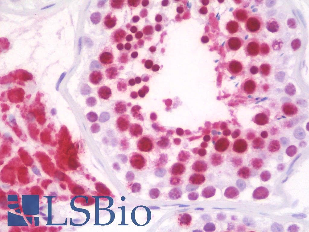 IHC-plus™ Polyclonal Rabbit anti-Human RPL18 / Ribosomal Protein L18 Antibody (aa111-160, IHC, WB)