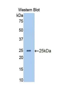 IL13RA1 / IL13R Alpha 1 Antibody (aa203-376, APC)