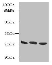 DNAJB8 Antibody