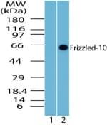 FZD10 / Frizzled 10 Antibody