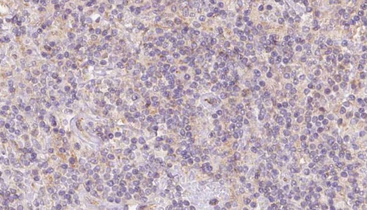 Polyclonal Rabbit anti-Human COQ7 Antibody (IHC, IF, WB)