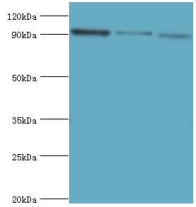 Polyclonal Rabbit anti-Human MCM3 Antibody (aa1-295, WB)