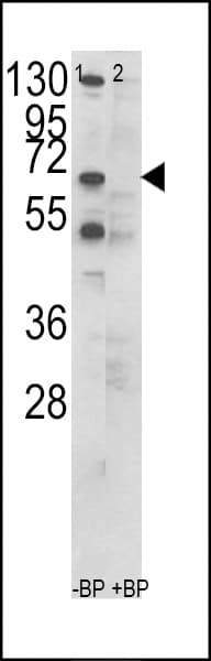 Polyclonal Rabbit anti-Human CCT3 Antibody (aa509-536, IHC, WB)