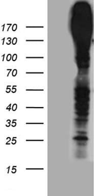 Polyclonal Rabbit anti-Human ABCC3 / MRP3 Antibody (WB)