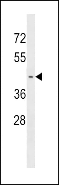 PNMA6A Antibody (aa53-80)