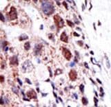 UBE2S / E2 EPF Antibody (aa10-40)