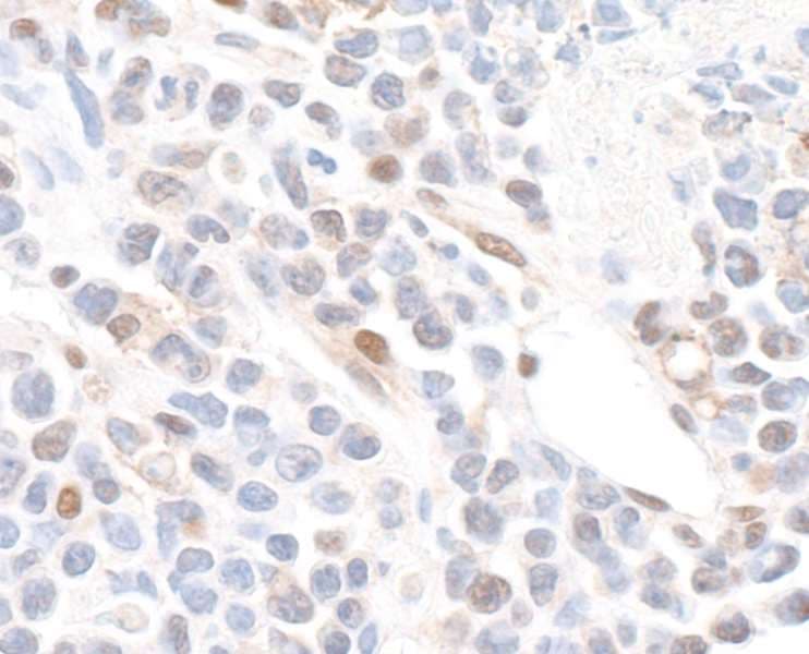 Polyclonal Rabbit anti-Human GAPDH Antibody (aa150-200, IHC, WB)