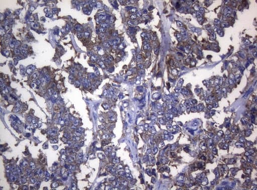 RPL10 / Ribosomal Protein L10 Antibody (clone OTI9A8)