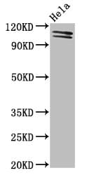 Polyclonal Rabbit anti-Human UBA1 / UBE1 Antibody (WB)