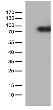 Monoclonal Mouse anti-Human CSF2RA / CD116 Antibody (clone OTI3E6, aa23-320, WB)