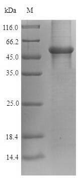 Human GAPDH Protein (Recombinant 6His-SUMO, N-terminus)