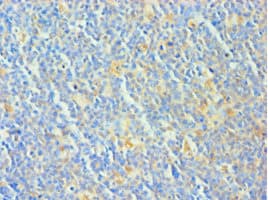 Polyclonal Rabbit anti-Human Treacle / TCOF1 Antibody (aa1189-1488, IHC)