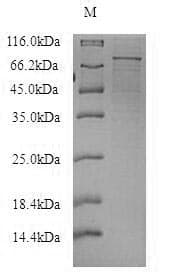 Mouse P2RX4 / P2X4 Protein (Recombinant 6His-SUMO, N-terminus)
