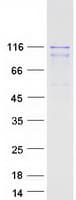 Human WWP2 Protein (Recombinant Myc-DDK (Flag))