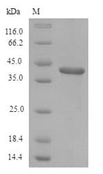 Human LY6G6D Protein (Recombinant 10His-B2M-JD, N-terminus)