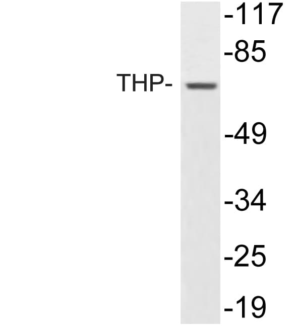 UMOD / Uromodulin Antibody (aa329-378)
