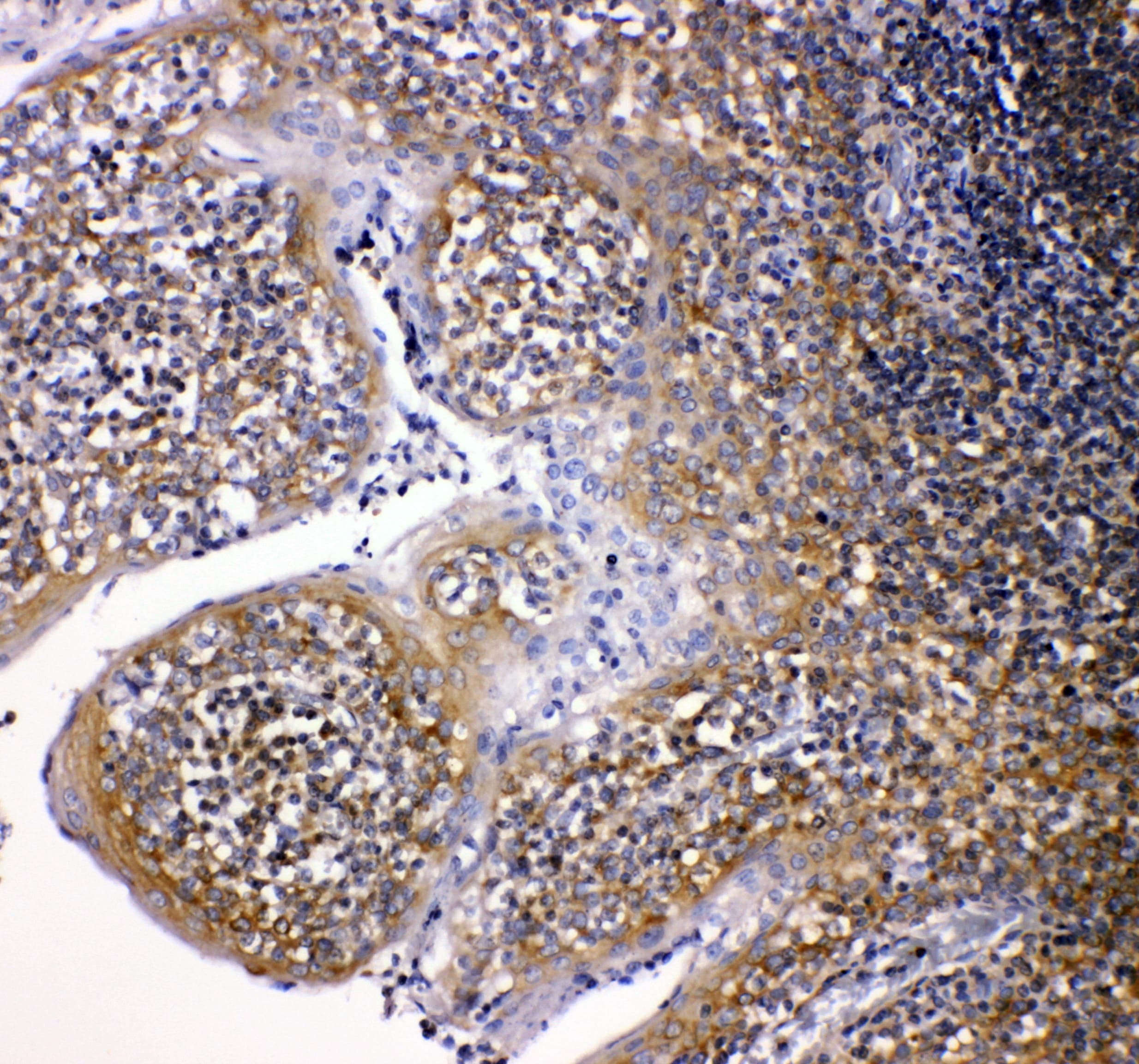 CYBB / NOX2 / gp91phox Antibody (aa442-459)