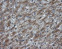 Monoclonal Mouse anti-Human NPR3 Antibody (clone OTI11B6, IHC, IF, WB)