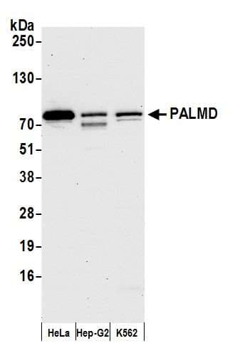 PALMD Antibody (aa325-375)