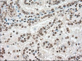 TYRO3 Antibody (clone OTI2C4)