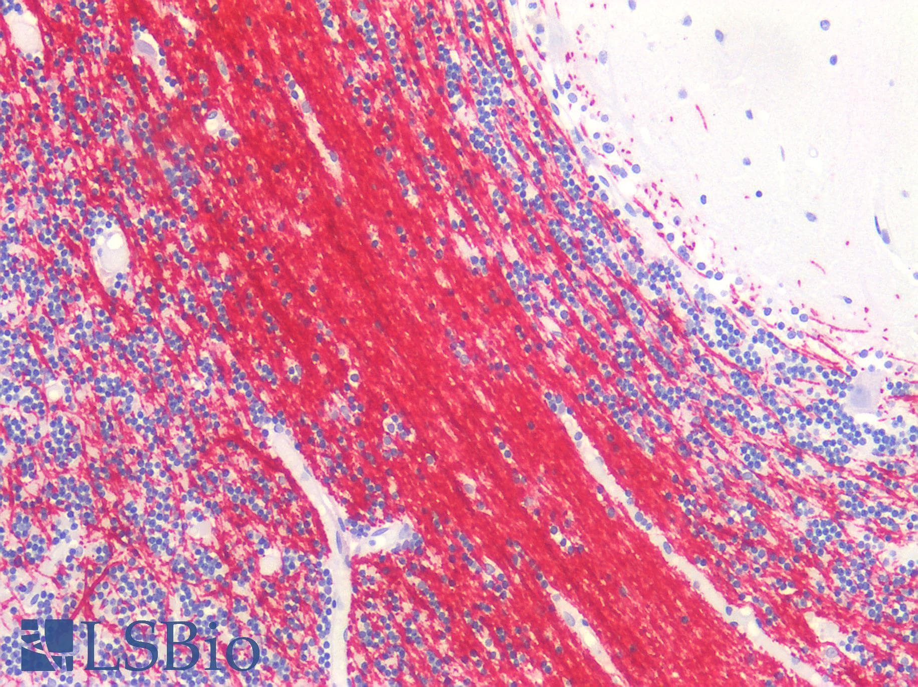 PathPlus™ MBP / Myelin Basic Protein Antibody (clone 13B511)