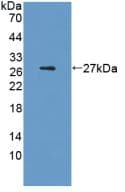Rat IL6 / Interleukin 6 Protein (Recombinant His, N-Terminal)