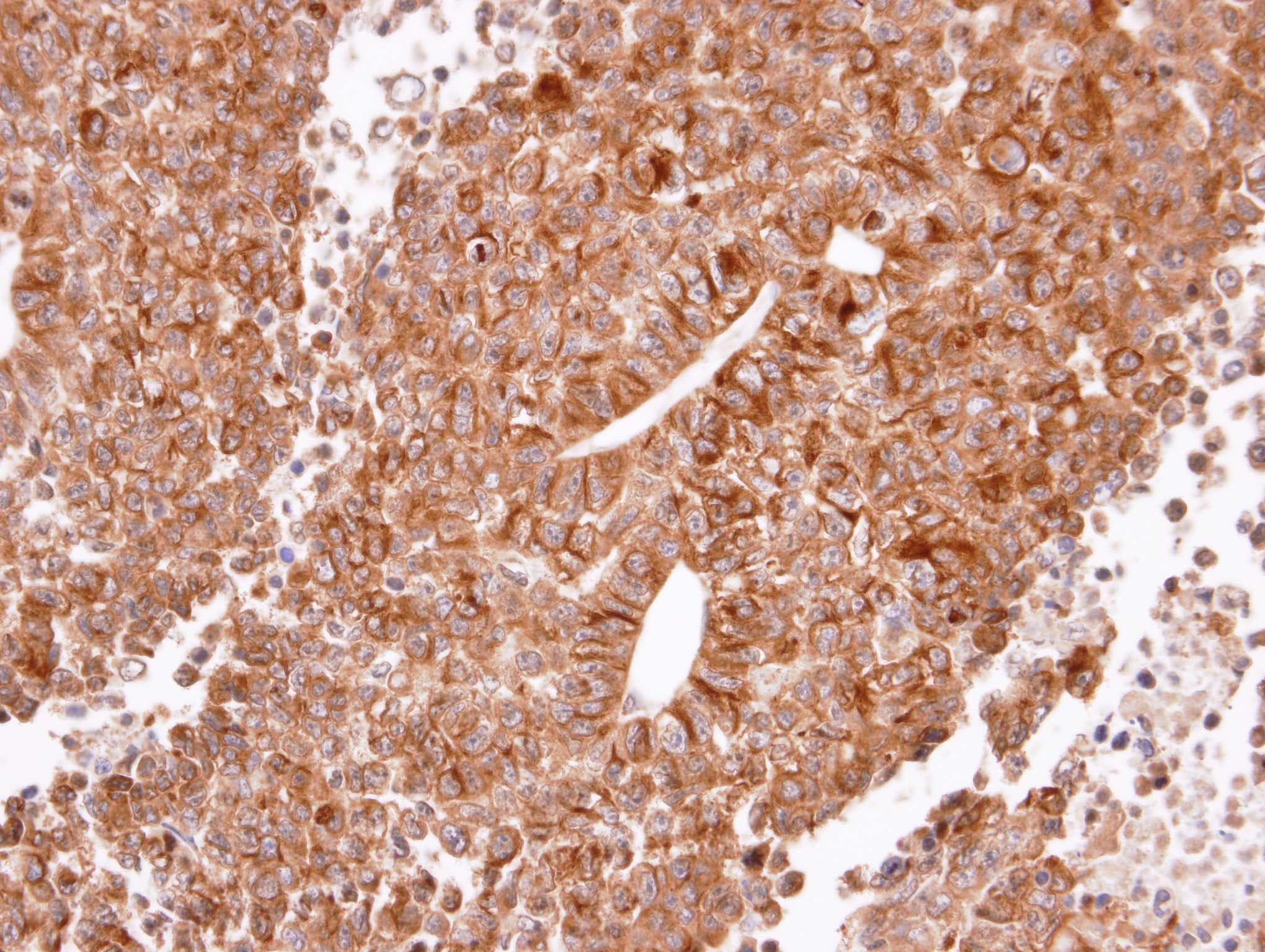Polyclonal Rabbit anti-Human HRH2 / Histamine H2 Receptor Antibody (aa1-45, IHC, WB)