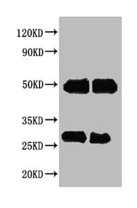 Polyclonal Rabbit Anti-Human IgG Secondary Antibody (WB)