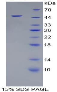 Rat I-BABP / FABP6 Protein (Recombinant His-GST)