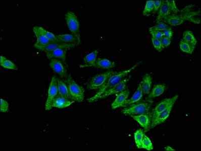 Polyclonal Rabbit anti-Human ZNF673 Antibody