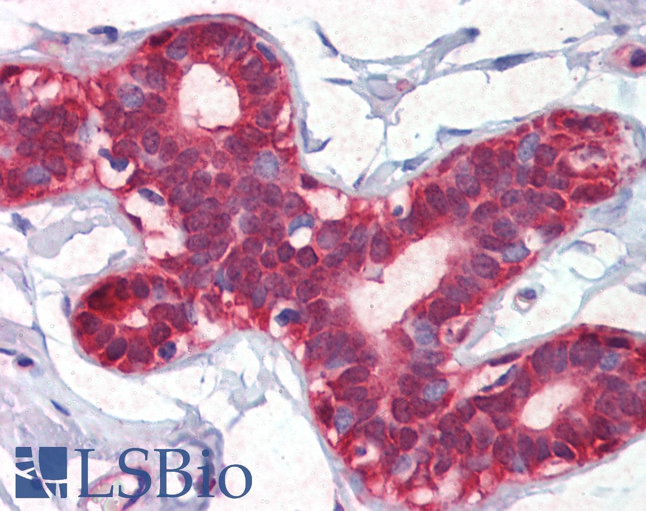 IHC-plus™ Polyclonal Rabbit anti-Human ENO1 / Alpha Enolase Antibody (aa178-205, IHC, IF, WB)