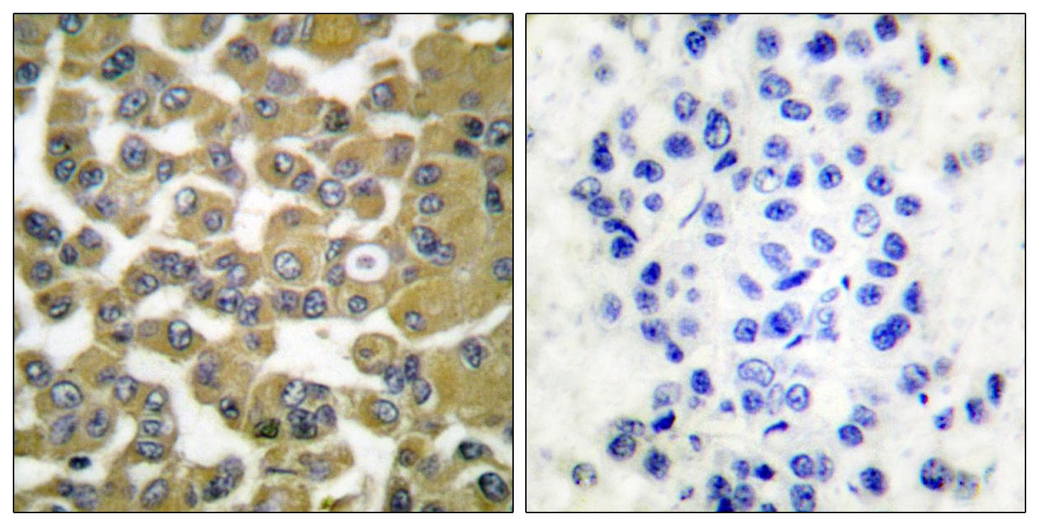 MMP11 Antibody