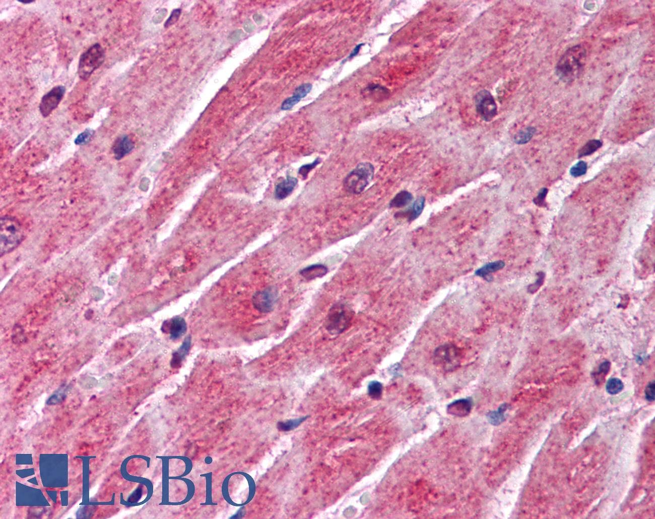 IHC-plus™ SFRP1 Antibody