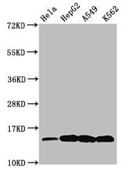 Polyclonal Rabbit anti-Human H2AFZ / H2A.z Antibody (IF, WB)