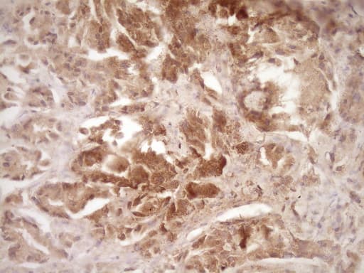 ERBB3 / HER3 Antibody (clone OTI3E10)