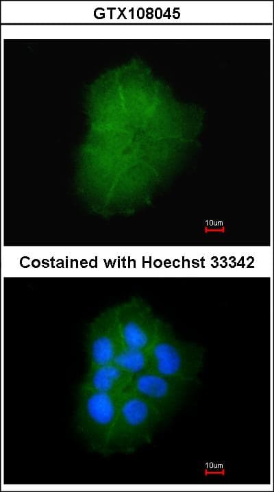 TMEM147 Antibody (aa37-131)