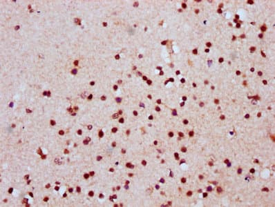 HIST1H2AI Antibody