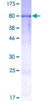 Human DYRK2 Protein (Recombinant GST)