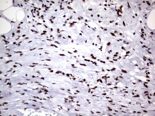 DDX56 Antibody (aa323-547, clone UMAB153, Carrier-free)