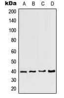 Polyclonal Rabbit anti-Human CCRL2 Antibody (Internal, WB)