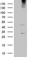 Monoclonal Mouse anti-Human KCTD14 Antibody (clone OTI1D1, IHC, IF, WB)